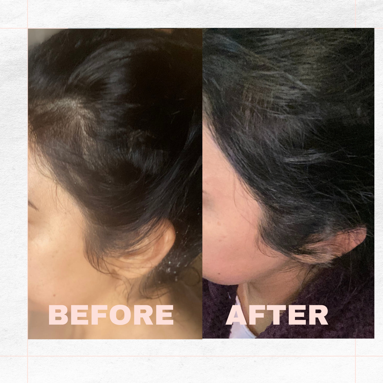 Rescue Kit -new Beginnings Hair Oil For Postpartim Support hair loving faire